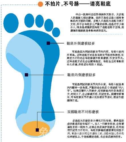 鞋底磨损太厉害？这是病呀得治