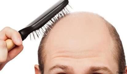 男性养生保健 男性如何预防脱发